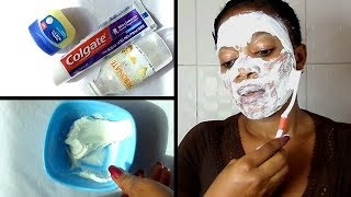 Every Night Apply Baking Soda And Toothpaste On The Face In 5 Minutes Watch What Happens [upl. by Cairns491]