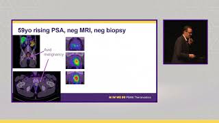 Will PSMA PET replace mpMRI for diagnosis of prostate cancer AProf Daniel Moon presents prostic22 [upl. by Lednem741]