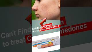 Solution for your closed comedones and mild acne pakistaniskincare indianskincare koreanskincare [upl. by Eelreveb]