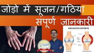 Rheumatoid Athritis hindi जोड़ो में सूजन  संधि वा  गठिया के बारे में संपूर्ण जानकारी [upl. by Latoye]