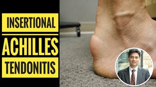 Insertional Achilles Tendinitis How to Diagnose [upl. by Octavla]