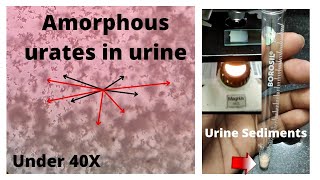 Amorphous urates in urine  pH 6 Amorphous urates in microscope [upl. by Placeeda]