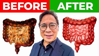 “WAKE UP PEOPLE” The Shocking Benefits of These 20 GUTBoosting Foods  Dr William Li [upl. by Martha554]