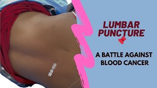 Cancer ke Treatment Me Lumbar Puncture Kaise kart hain  Leukemia  Blood Cancer [upl. by Ennairol200]