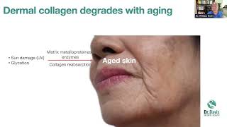 Slow Skin Aging by Preventing Glycation [upl. by Tench]