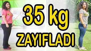 Zayıflama Kampı 35 Kilo Zayıflayan Ceren Kilo Verme Sürecini Anlatıyor [upl. by Ttezzil]