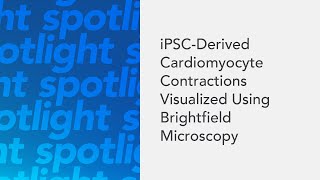 iPSCDerived Cardiomyocyte Contractions Visualized Using Brightfield Microscopy [upl. by Motteo]