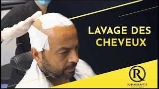 Lavage Des Cheveux  İmplants Capillaires  Renaissance Clinique [upl. by Enigroeg]