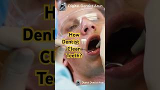 How Dentists Professionally Clean Your Teeth  What to Expect in a Dental Cleaning [upl. by Nalak437]