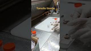 Tonsils tissue for histopathology [upl. by Shriver]