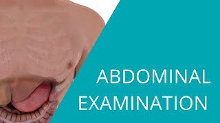 Abdominal Examination  Examination of the abdomen and gastrointestinal system [upl. by Mikol]