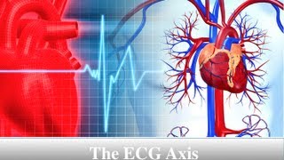 ECG Axis Tutorial Part 4  The Quadrant Method [upl. by Acirema]