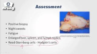 Lymphoma NCLEX® Review  NRSNGacademycom [upl. by Binette979]