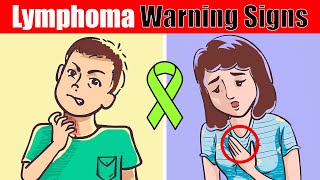 7 Warning Signs of Lymphoma You Shouldnt Ignore [upl. by Salvidor75]