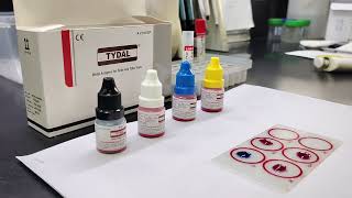 How to do WIDAL Test  Benifits of WIDAL tests  Test for Typhoid widaltest labtest [upl. by Phare714]