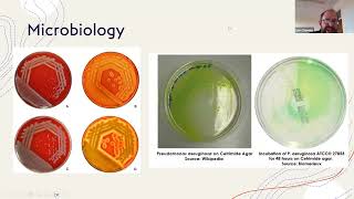 Pseudomonas Infections  Lior Chernick [upl. by Aineles]