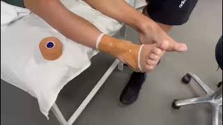 Posterior Ankle Impingement Strapping [upl. by Bard518]