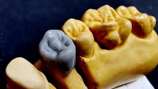 wax up upper Premolarتشميع الضاحك العلوي [upl. by Glogau966]