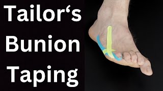 Tailors Bunion Pain Relief Taping [upl. by Arriaet]