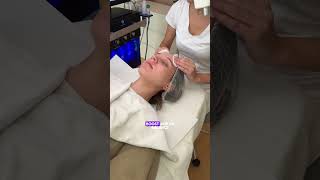 Microneedling Wien  Journey 1 [upl. by Hyacinthia821]