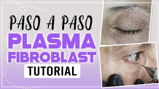 PLASMA PEN FIBROBLAST paso a paso  párpado caído  ojos  PLASMA PEN  plasmapen CarolinaTV [upl. by Aeki537]