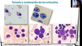 Laboratorio de Hematología Frotis de sangre periférica citometría hemática [upl. by Saks]