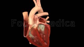 Paroxysmal atrial fibrillation  Animated Atlas of Atrial Fibrillation [upl. by Fabio]