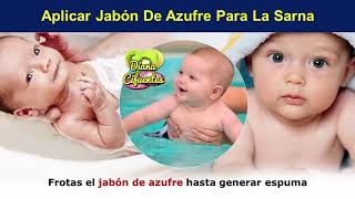 Escabiosis En Bebes [upl. by Atirb]