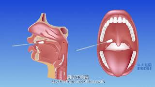 咽拭子自採樣操作指南粤语版 2020 [upl. by Htebizile]