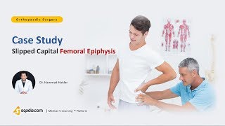 Slipped Capital Femoral Epiphysis  Orthopaedic Surgery  Case Study Video  VLearning [upl. by Aerua]