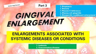 Part 3  Gingival Enlargement Pembesaran Gingiva yang dihubungkan dengan penyakit sistemik [upl. by Lucias645]