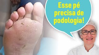 PARTE PLANTAR PRECISANDO DE PODOLOGIA [upl. by Sethi]