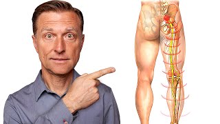 Say Goodbye to Sciatica Nerve Pain in 5 Minutes [upl. by Eyak]