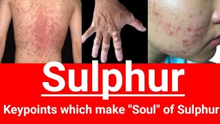 Sulphur homeopathic medicine  Key points which make soul of sulphur  All about sulphur [upl. by Alexio]