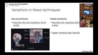 03 variations in the maxillary local infiltration techniques [upl. by Suoivart]