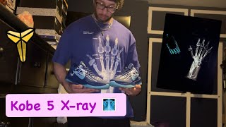 My latest Kobe pick ups Life update kobe mambamentality [upl. by Gregrory]