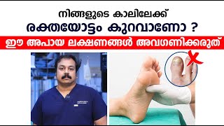 നിങ്ങളുടെ കാലിലേക്ക് രക്തയോട്ടം കുറവാണോ ഈ അപായ ലക്ഷണങ്ങൾ സൂക്ഷിക്കുക  Peripheral artery disease [upl. by Mihar]