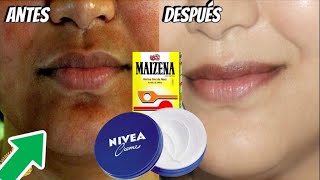 NIVEA Y MAIZENA PARA ELIMINAR MANCHAS ARRUGAS Y ACLARAR LA PIEL PARA SIEMPRE EN 1 SEMANA [upl. by Leirum]