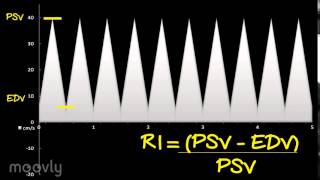 Measuring the Resistive Index [upl. by Freddi582]