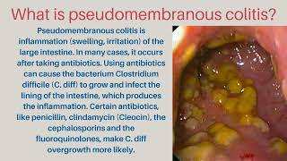 pseudomembranous colitis [upl. by Greyso]