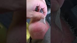 Sunburn ASMR Skin Peeling ASMR sunburn skinpeel asmr [upl. by Waldo]