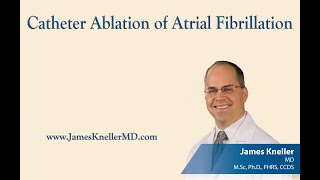 Catheter Ablation of Atrial Fibrillation [upl. by Bueschel]