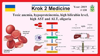 Krok 2 Medicine  Year 2019  130 Ministry of Public Health of Ukraine [upl. by Sessler524]