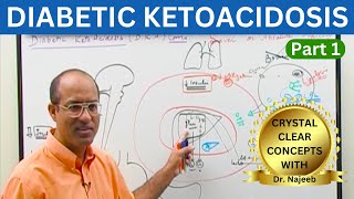 Diabetic Ketoacidosis  Symptoms  Causes  Diagnosis  Part 1 👨‍⚕️ [upl. by Ninetta]