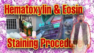 Performing routine Hematoxylin amp Eosin stainingHistopathology Lab [upl. by Ramilahs]