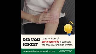 Longterm use of corticosteroids for psoriasis can lead to several side effects psoriasis [upl. by Maxie]