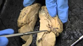 sheep brain dissection [upl. by Llenreb]