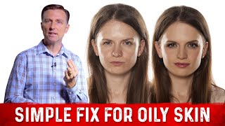 How To Fix Oily Skin With Simple Hack – Dr Berg [upl. by Elwin]