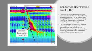 High resolution oesophageal manometry  Part 4  Interpretation of results [upl. by Friedman786]