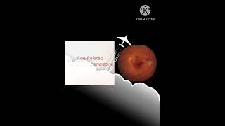 fundus examination of the eye viralshort shortsvideo knowledgewithani [upl. by Chrotoem]